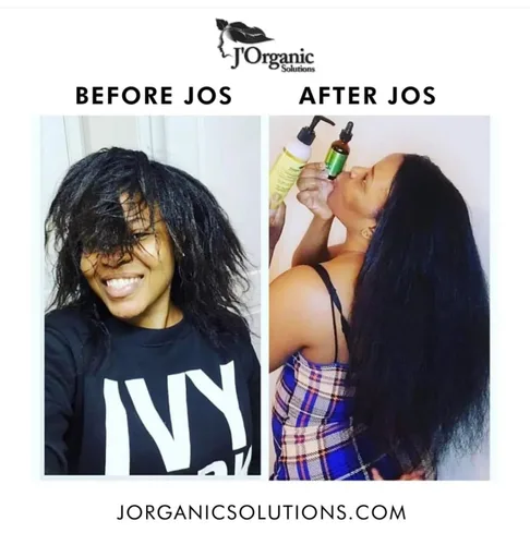 Miniatura 8 de J'Organic Solutions Kit de crecimiento de cabello súper saludable para adultos, hidratante de crecimiento, acondicionador profundo, sellador
