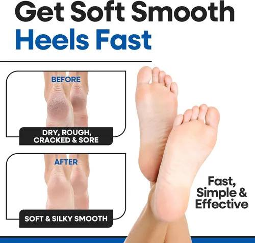 Miniatura 9 de Calcetines hidratantes para hombres y mujeres Tratamiento de talón agrietado con aloe vera Removedor de callos en los pies Calcetines de aloe