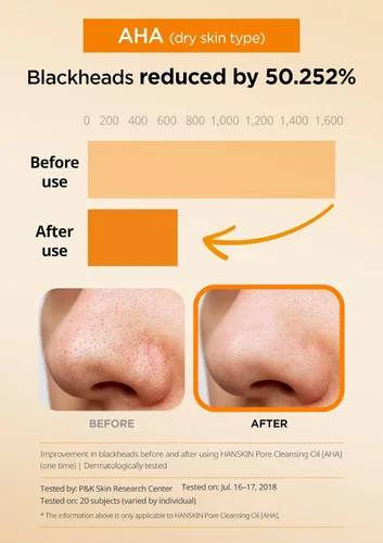 Miniatura 3 de Hanskin Aceite limpiador de poros con ácido hidroxi alfa, muestra de tamaño pequeño, removedor de maquillaje exfoliante, juego de limpiador facial