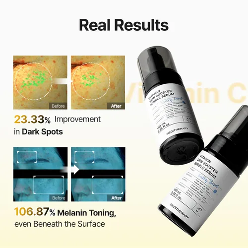 Miniatura 10 de MEDITHERAPY Suero de vitamina C para la cara, fórmula de microburbujas para absorción instantánea, brillo visiblemente radiante, vitamina C
