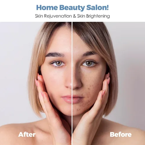 Miniatura 3 de TMOMT OPT Dispositivo de depilación láser Pro, 3 en 1, dispositivo removedor de vello casero de grado salón de belleza con sistema de enfriamiento