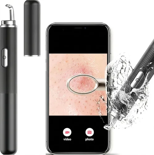 Miniatura 9 de Removedor de puntos negros con cámara, herramientas de eliminación de puntos negros visuales WiFi con luces blancas/azules para iPhone, teléfonos