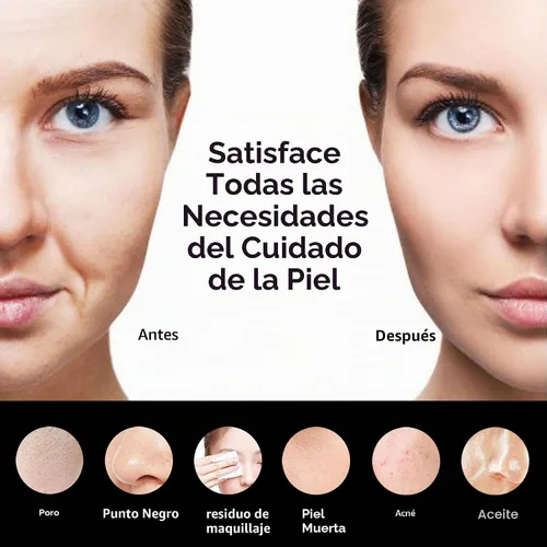Miniatura 4 de Cepillo Exfoliante Facial de Silicona, NågraCoola CLIE 2.0 Cepillo de Limpieza Facial, Recargable, Impermeable, Cepillo Exfoliante Facial