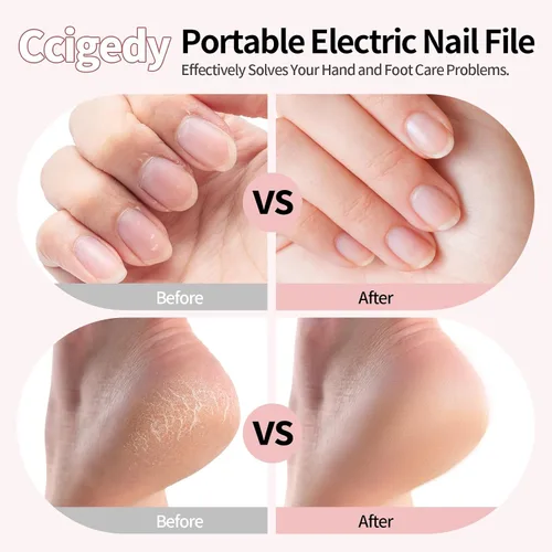 Miniatura 2 de Ccigedy Taladro eléctrico de uñas, lijadora profesional inalámbrica con pantalla LCD y lámpara, amoladora de uñas recargable para mujeres, kit