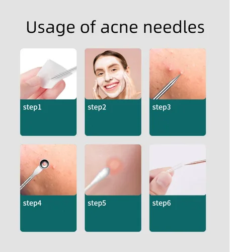 Miniatura 7 de Pinzas faciales profesionales para puntos negros, kit extractor de acné, herramienta para reventar espinillas, clip para espinillas, clip para acné