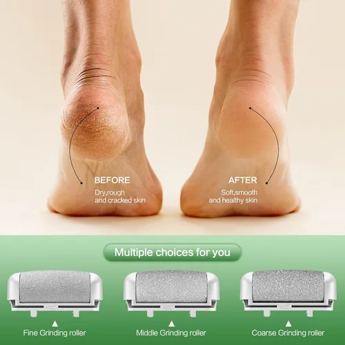 Miniatura 2 de Removedor eléctrico de callos de pies, lima de pie eléctrico con luz LED y pantalla, limpiador eléctrico recargable e impermeable, 3 rodillos