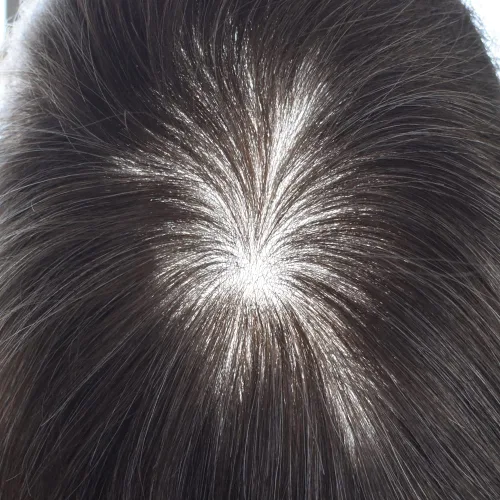 Miniatura 5 de Toupee for Men Human Hair Pieces Ultra Thin Skin Mens Toupee Hair Replacement System Mens Hair Units for Men