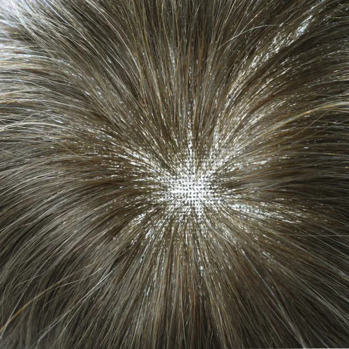 Miniatura 4 de Extensiones de cabello suizo completo para hombre, sistema de reemplazo de cabello humano europeo para hombres