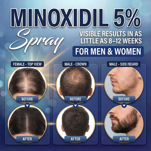 Miniatura 2 de Minoxidil 5% para hombres (4.1 fl oz), spray avanzado de minoxidil con provitamina B5 y extracto de semilla de ricino, suero de extracto