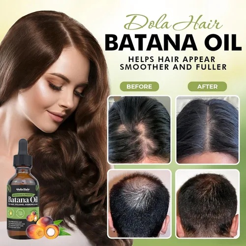 Miniatura 3 de Dolahair Batana Oil for Hair Growth Nourishes Damaged Hair to Prevent Hair Loss Natural Hair Growth and Conditioner Oil 2.02 Fl Oz (Pack of 2)