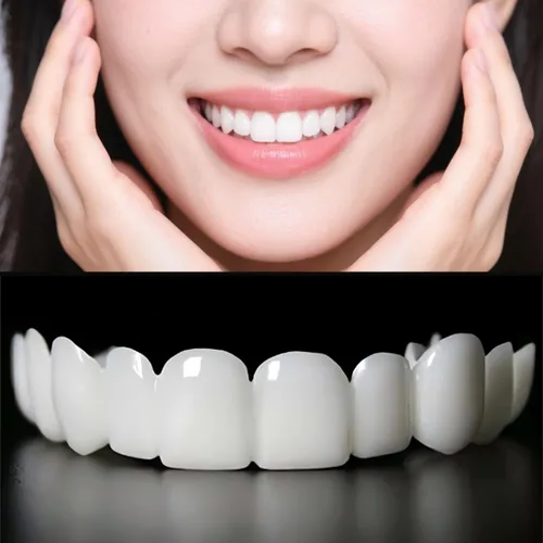 2 pares, cómodo y hermoso accesorio de sonrisa, aspecto natural para hombres y mujeres (6.0)
