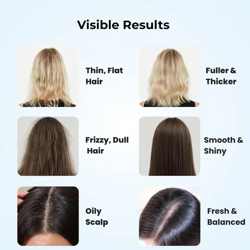 Miniatura 7 de Champú voluminizador y espesante para cabello fino y fino, fórmula de biotina Root Lift añade cuerpo instantáneo, plenitud y brillo, sin sulfato, 10