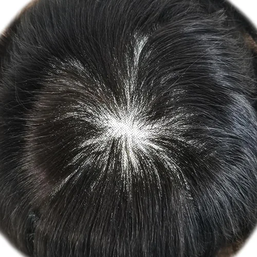 Miniatura 3 de Sistema de reemplazo de cabello tipo tupé para hombre, sistema de cabello humano real, piezas de cabello para hombre, protesis capilar para hombre