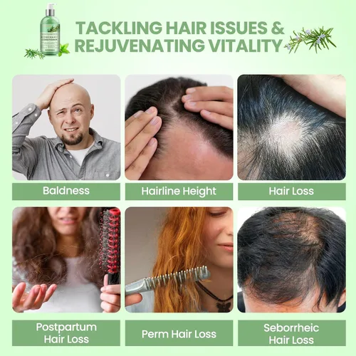 Miniatura 4 de Acondicionador de romero para el crecimiento del cabello: tratamiento para el adelgazamiento del cabello y contra la caída del cabello para hombres