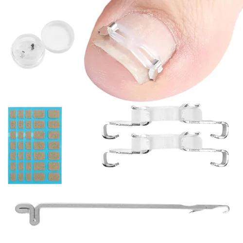 Kit de corrección de uñas encarnadas, herramientas profesionales para el cuidado de uñas con clips de corrección y almohadillas adhesivas, cuatro