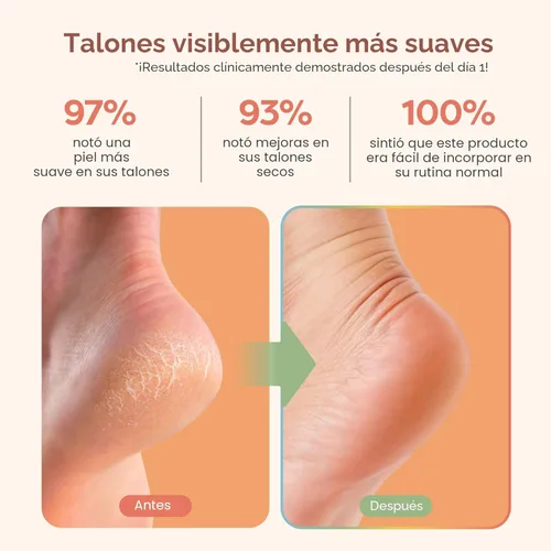 Miniatura 3 de ZenToes Calcetines de talón hidratante, 2 pares de calcetines de spa con forro de gel para curar y tratar talones secos y agrietados mientras Rosa