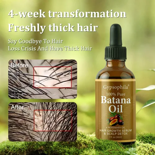 Miniatura 2 de Aceite de batana para el crecimiento del cabello, aceite natural 100% puro para el crecimiento del cabello, nutre el cuero cabelludo, elimina