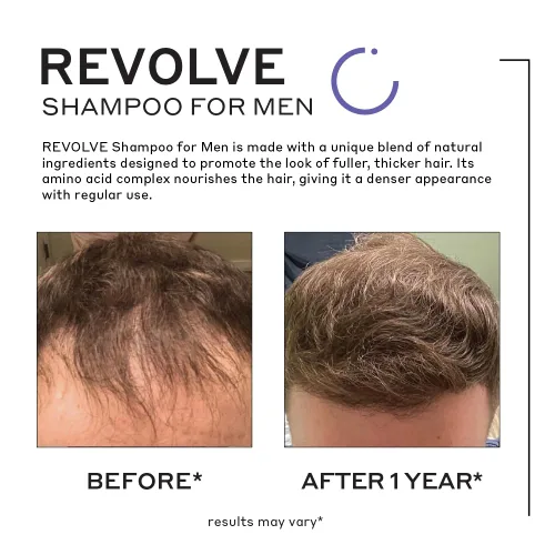 Miniatura 4 de Zenagen Revolve - Tratamiento de pérdida de cabello para hombres