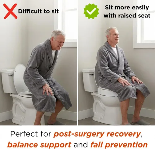 Miniatura 2 de NOVA Asiento de inodoro elevado para personas mayores y recuperación poscirugía: diseño alargado atornillado debajo del asiento utiliza asiento