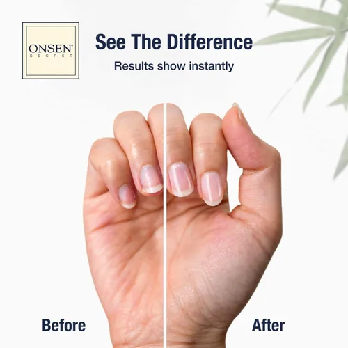 Miniatura 2 de Onsen Secret Kit de cuidado de uñas, con suero para el cuidado de la cutícula, kit de pulidor de uñas japonés y brillo - fortalecimiento y brillo
