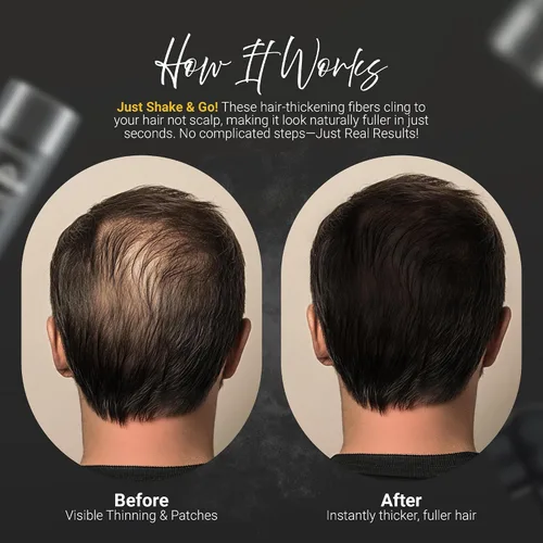 Miniatura 3 de Herbishh Koloret Fibras de construcción del cabello, polvo negro para adelgazar el cabello, cobertura instantánea de puntos calvos y corrector