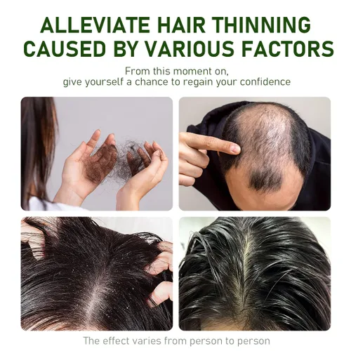 Miniatura 3 de Barra de champú antipérdida de cabello – Bloqueador DHT con polígono, ginseng y árbol de té, fortalece las raíces, reduce la caída del cabello