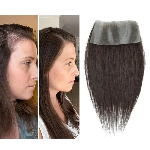 Miniatura 51 de Reemplazo de cabello humano con cicatrices, quemaduras accidentales sin vello para hombres y mujeres, pérdida de línea de cabello, cinta recta
