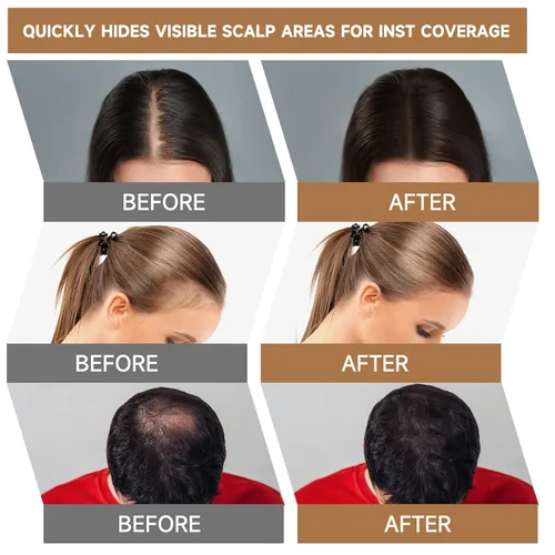 Miniatura 5 de Polvo de retoque de raíz, cobertura de cabello gris al instante, sombra de cobertura de raíces de color para mujeres para adelgazar la línea
