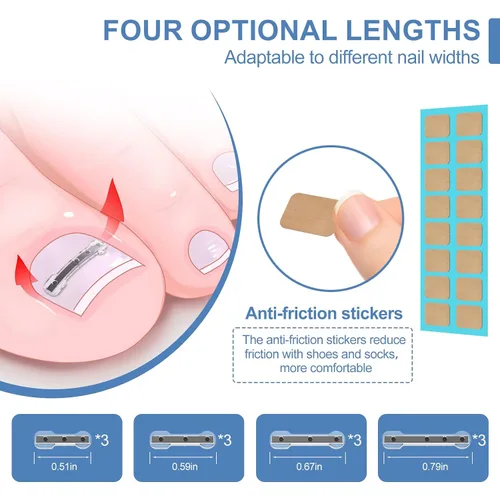 Miniatura 2 de 12 tiras correctoras de uñas encarnadas para alivio rápido de uñas curvas, kit de herramientas de alivio de uñas encarnadas de 4 tamaños múltiples