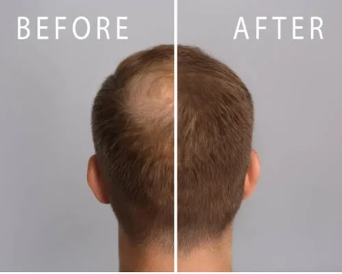 Miniatura 6 de Crecimiento del cabello para hombres y mujeres-Z-LAB27™ Fórmula vegetal bioactiva despierta raíces hibernantes, estimula y nutre el cuero