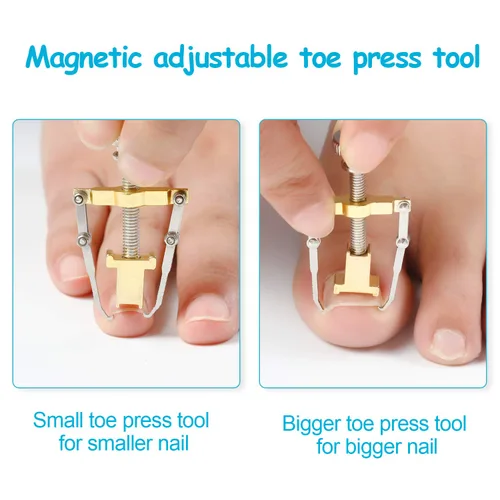 Miniatura 4 de 2 piezas encarnadas levantador de uñas encarnadas herramienta de uñas encarnadas abrazadera del dedo del pie de acero inoxidable herramienta
