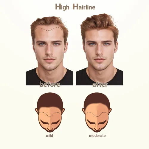 Miniatura 7 de Extensión frontal de cabello rubio claro para hombres, extensión de cabello lacio con pérdida de línea de cabello humano con cinta adhesiva