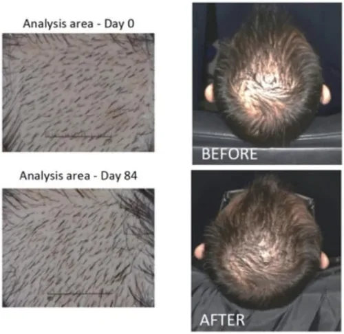 Miniatura 4 de Actsyl -3 Suero para el crecimiento del cabello con Redensyl: crece un cabello más grueso, más completo, más fuerte, reduce la caída y la rotura