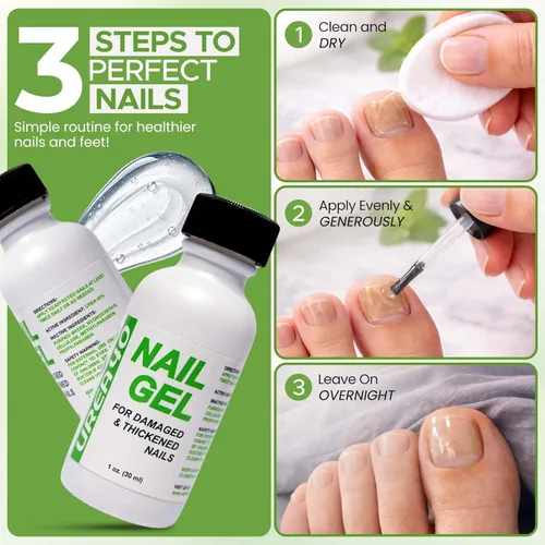 Miniatura 3 de Urea Nail Gel - Suaviza los callos agrietados del talón y las uñas gruesas de los pies - Repara uñas dañadas, amarillas y decoloradas - Tratamiento