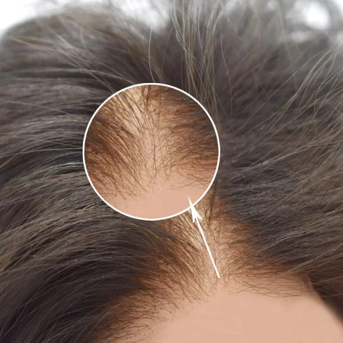Miniatura 8 de Tupé de pelo para hombres Cabello humano para hombre Hairpieces y tupés Durable Fine Monofilament Mens Hair System Lace Front Mens Toupee Mens Hair