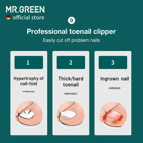 Miniatura 3 de MR.GREEN Cortaúñas para uñas de los pies, antisalpicaduras, profesionales, encarnadas, gruesas, duras, herramientas de pedicura, juegos de manicura