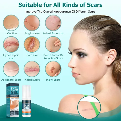 Miniatura 4 de Gowgaw Gel para cicatrices, crema para cicatrices, gel avanzado para cicatrices quirúrgicas, cara, cuerpo, pierna, quemaduras, acné, cesárea