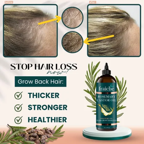 Miniatura 2 de Live Fraiche Aceite de ricino de romero para el crecimiento del cabello, 16 onzas, aceite de romero para el crecimiento del cabello y engrosamiento