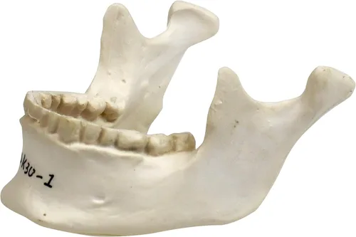 Miniatura 2 de Parco Scientific PB00157 Cráneo de plástico totalmente desarticulado de 22 partes