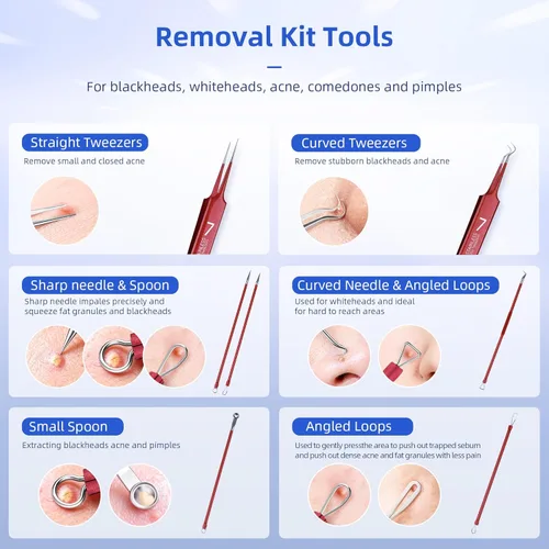 Miniatura 3 de Shevelestar - Extractor de comedones para eliminar puntos negros, kit de pinzas curvas, kit de herramientas profesionales de eliminación de acné
