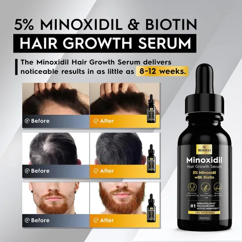 Miniatura 2 de 5% Minoxidil para el crecimiento del cabello para hombres y mujeres: Suero de tratamiento de rebrote de Minoxidil de extra fuerza para la pérdida