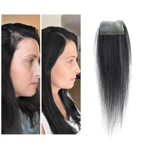 Miniatura 28 de Reemplazo de cabello humano con cicatrices, quemaduras accidentales sin vello para hombres y mujeres, pérdida de línea de cabello, cinta recta