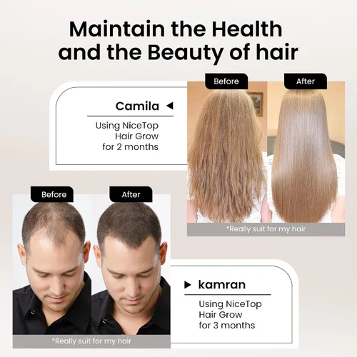 Miniatura 4 de Suplemento para el crecimiento del cabello, apoyo para el cuidado del cabello para fortaleza, crecimiento de espesor, con biotina vitamina A, C, E