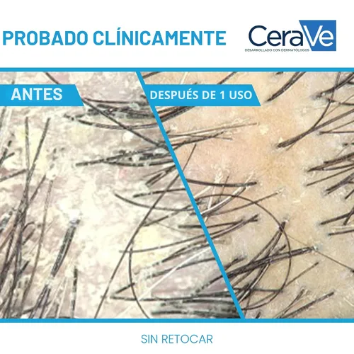Miniatura 4 de CeraVe Champú y acondicionador hidratante anticaspa, tratamiento de caspa de piritiona y zinc con ceramidas, ácido hialurónico y niacinamida