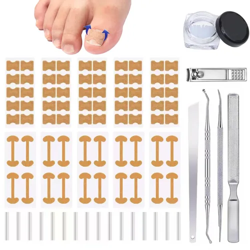 Juego profesional de herramientas para uñas encarnadas con tiras transpirables para uñas encarnadas, parche corrector de uñas curvas, lima y