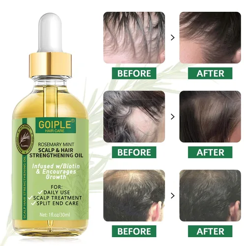 Miniatura 5 de WOZUTUNT Aceite de romero, 1 onza líquida, aceite natural para el crecimiento del cabello con aceites esenciales, tratamiento nutritivo para puntas