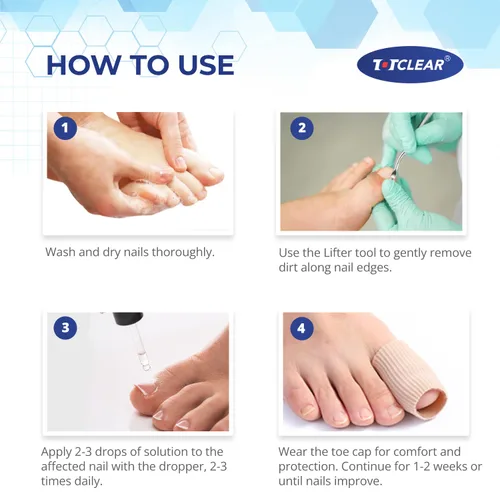 Miniatura 5 de Alivio de Uñas Encarnadas: Herramienta para Uñas Encarnadas para Hombres Mujeres - Kit de Eliminación de Uñas Encarnadas - Gotas Correctoras de Uñas