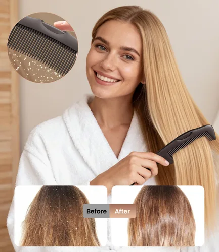 Miniatura 2 de Peine para la caspa, 2 piezas mejoradas para dientes finos del cuero cabelludo, peine de desintoxicación del cuero cabelludo para mujeres, hombres