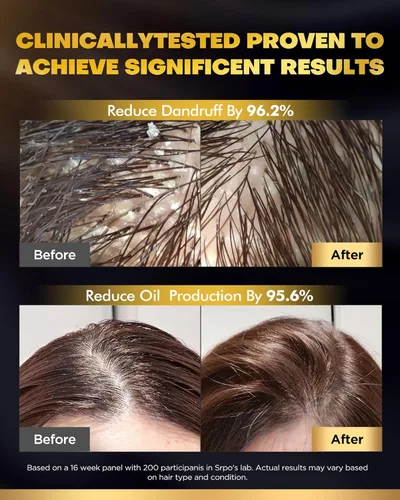 Miniatura 5 de Juego de champú y acondicionador de biotina para crecimiento del cabello con infusión de tripéptido, tratamiento hidratante voluminizador