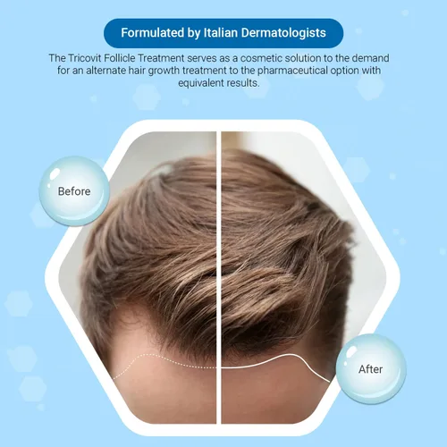 Miniatura 2 de Tricovit Forte Tratamiento de pérdida de cabello - Productos para el crecimiento del cabello para mujeres y hombres - Regulador de sebo